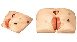 Modelo avanzado de cuidado de úlceras por presión (escaras)